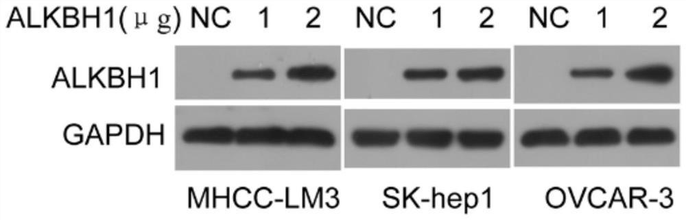 Application of alkbh1 gene and its expression product in the preparation of kits for diagnosing tumors and drugs for treating tumors