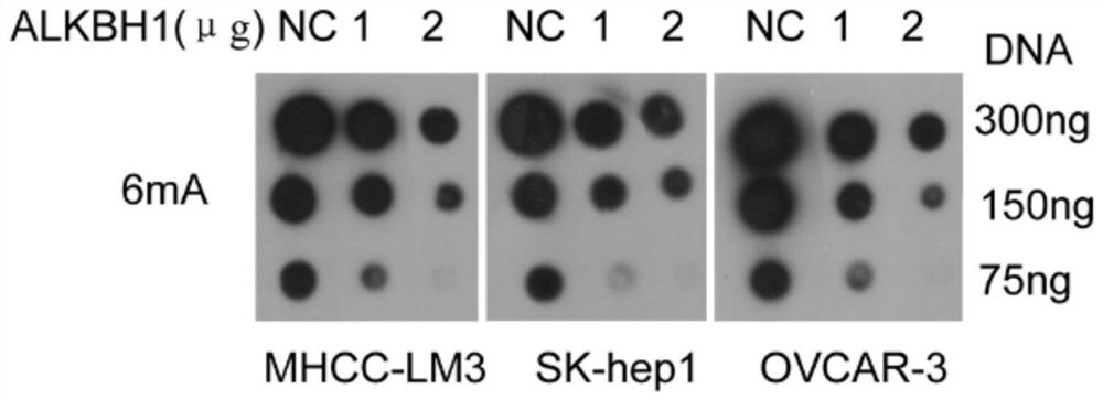 Application of alkbh1 gene and its expression product in the preparation of kits for diagnosing tumors and drugs for treating tumors