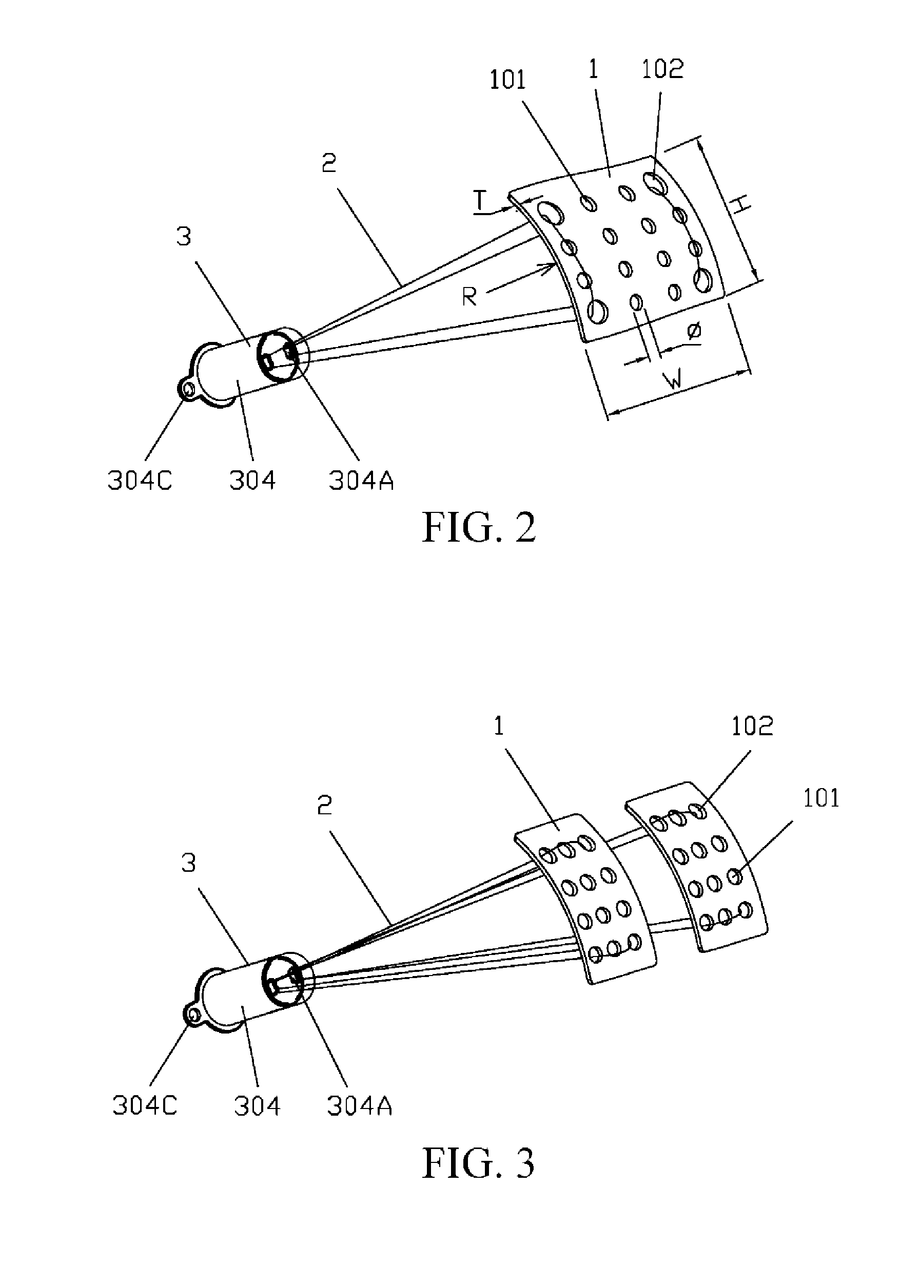 Implanted tongue pulling device, pull plate, pull line, retractor and method