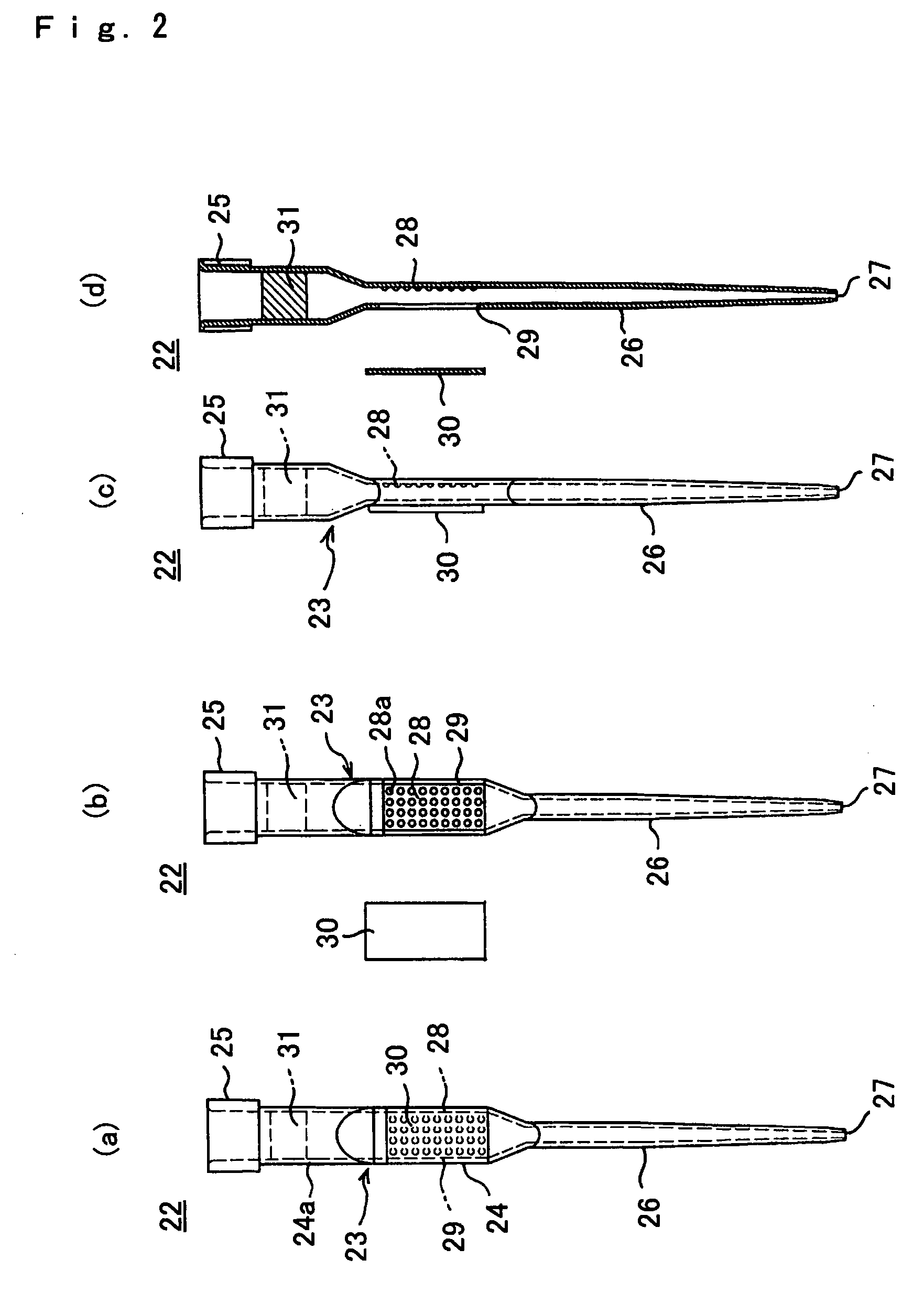 Biological material fixed region enclosing tip, biological material fixed region treatment apparatus, and treatment method thereof