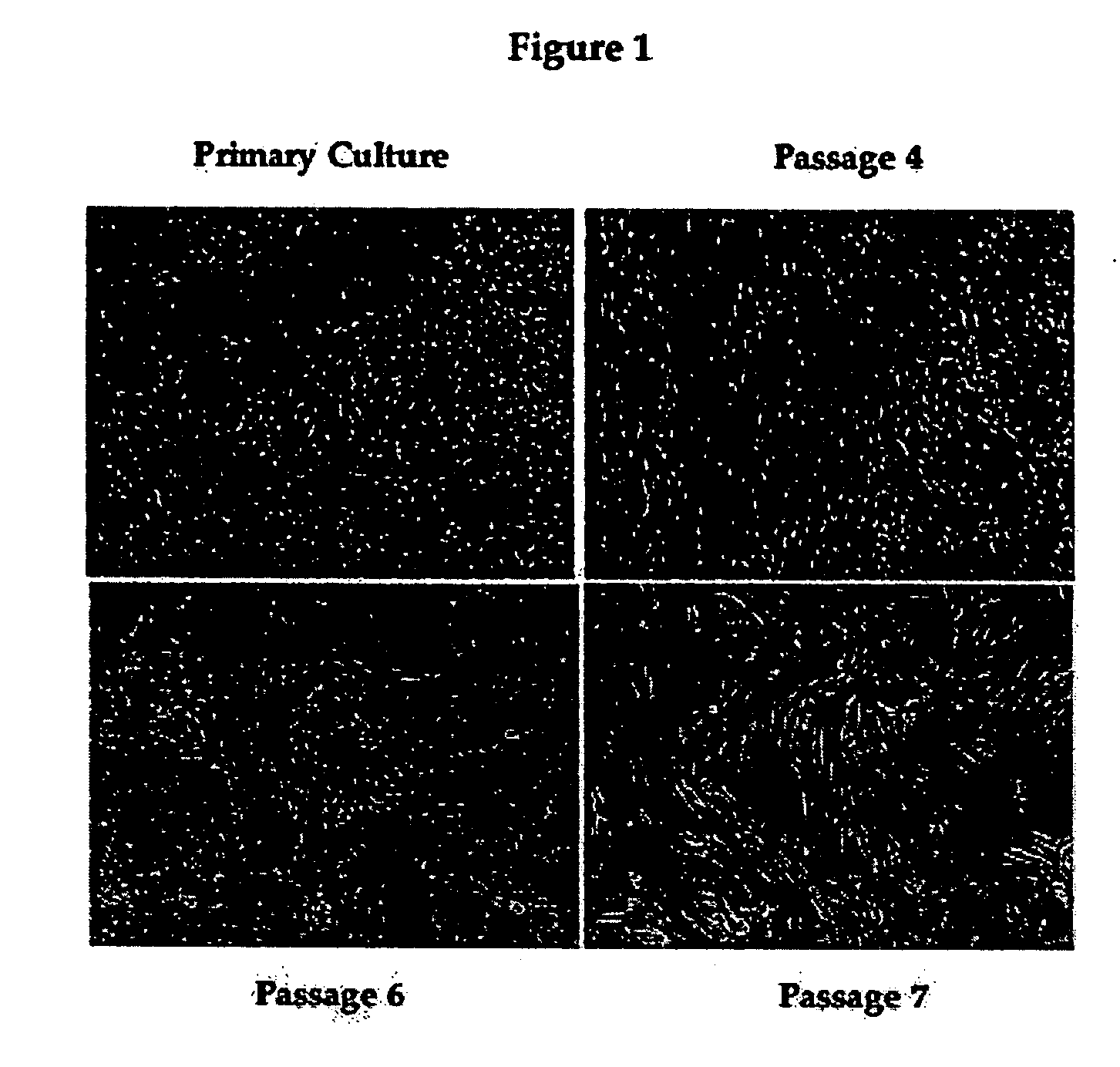 Cell culture media