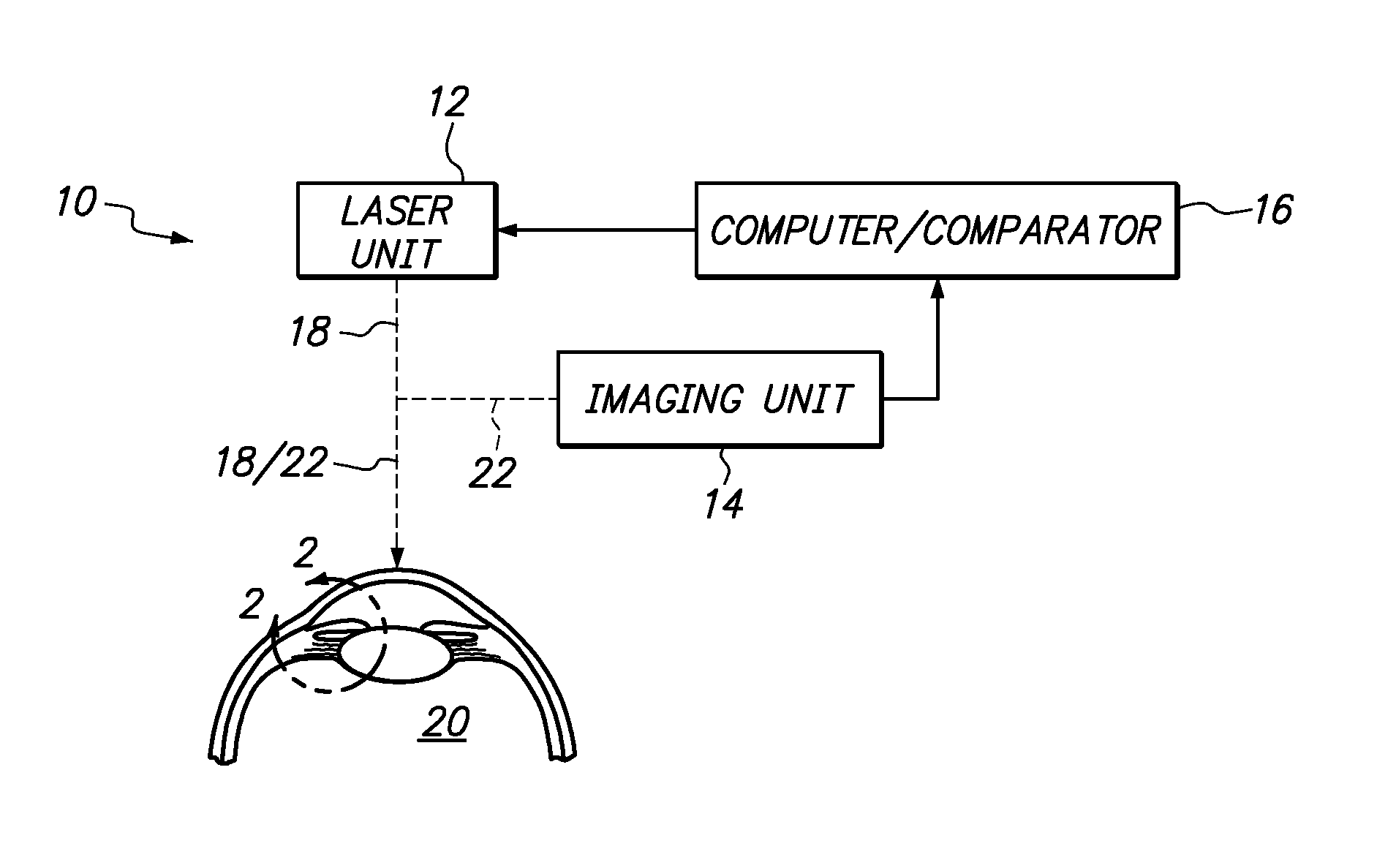 System and Method for Lowering IOP by Creation of Microchannels in Trabecular Meshwork Using a Femtosecond Laser