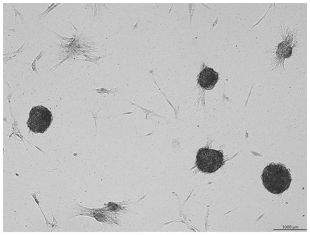 A kind of inducer of stem cell differentiation into chondrogenic and its application