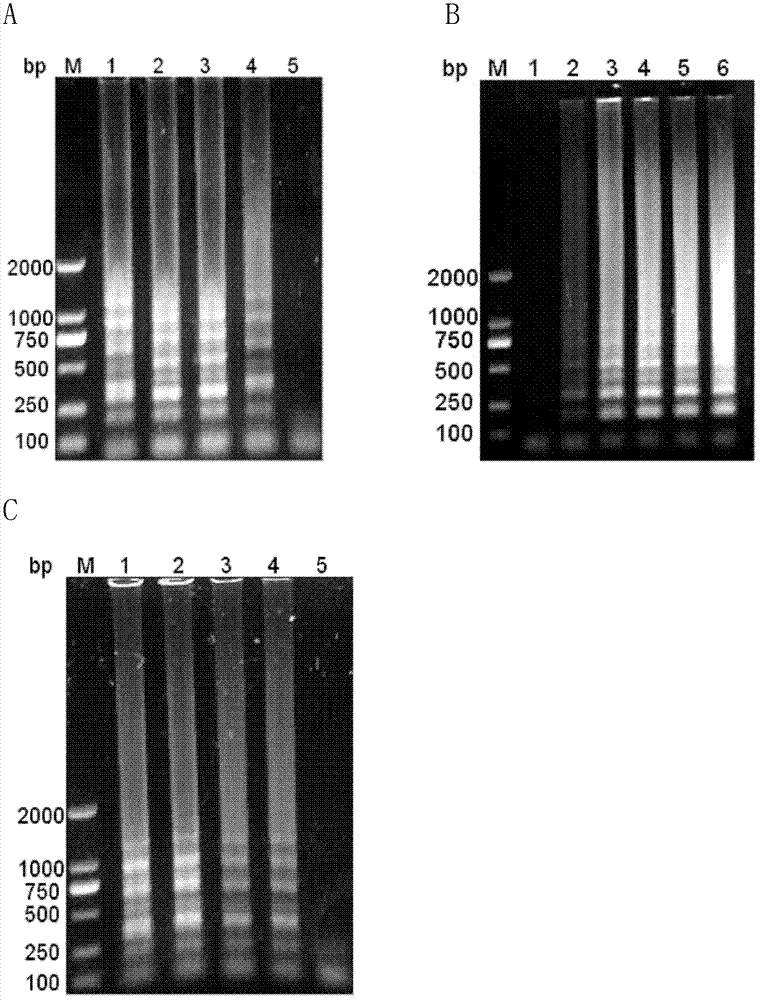 Reverse transcription loop-mediated isothermal amplification (RT-LAMP) visual kit for detecting Japanese B encephalitis virus and application of kit