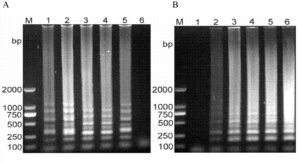 Reverse transcription loop-mediated isothermal amplification (RT-LAMP) visual kit for detecting Japanese B encephalitis virus and application of kit