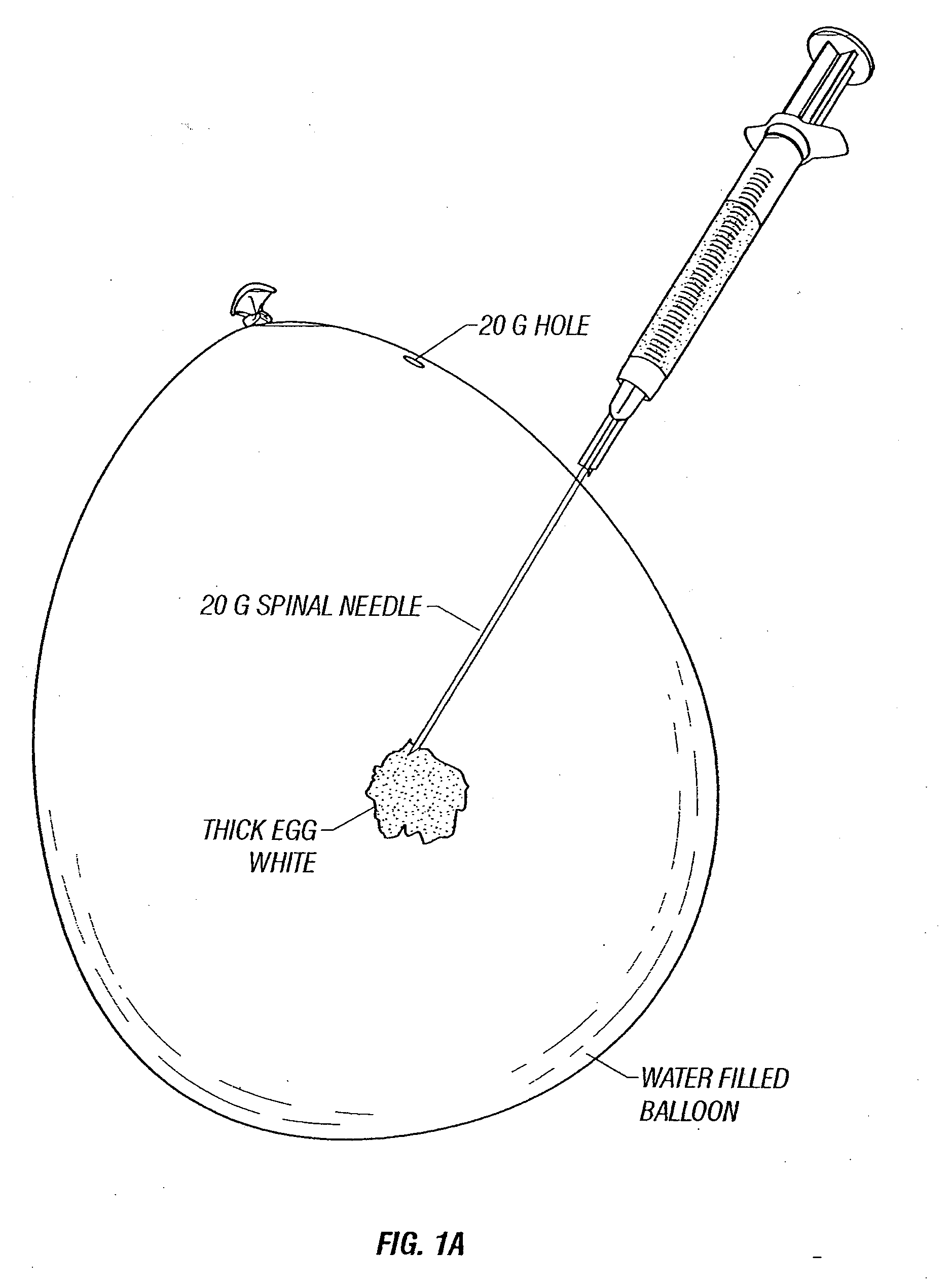 Repair of ruptured membrane by injection of naturally occurring protein in amniotic fluid sac