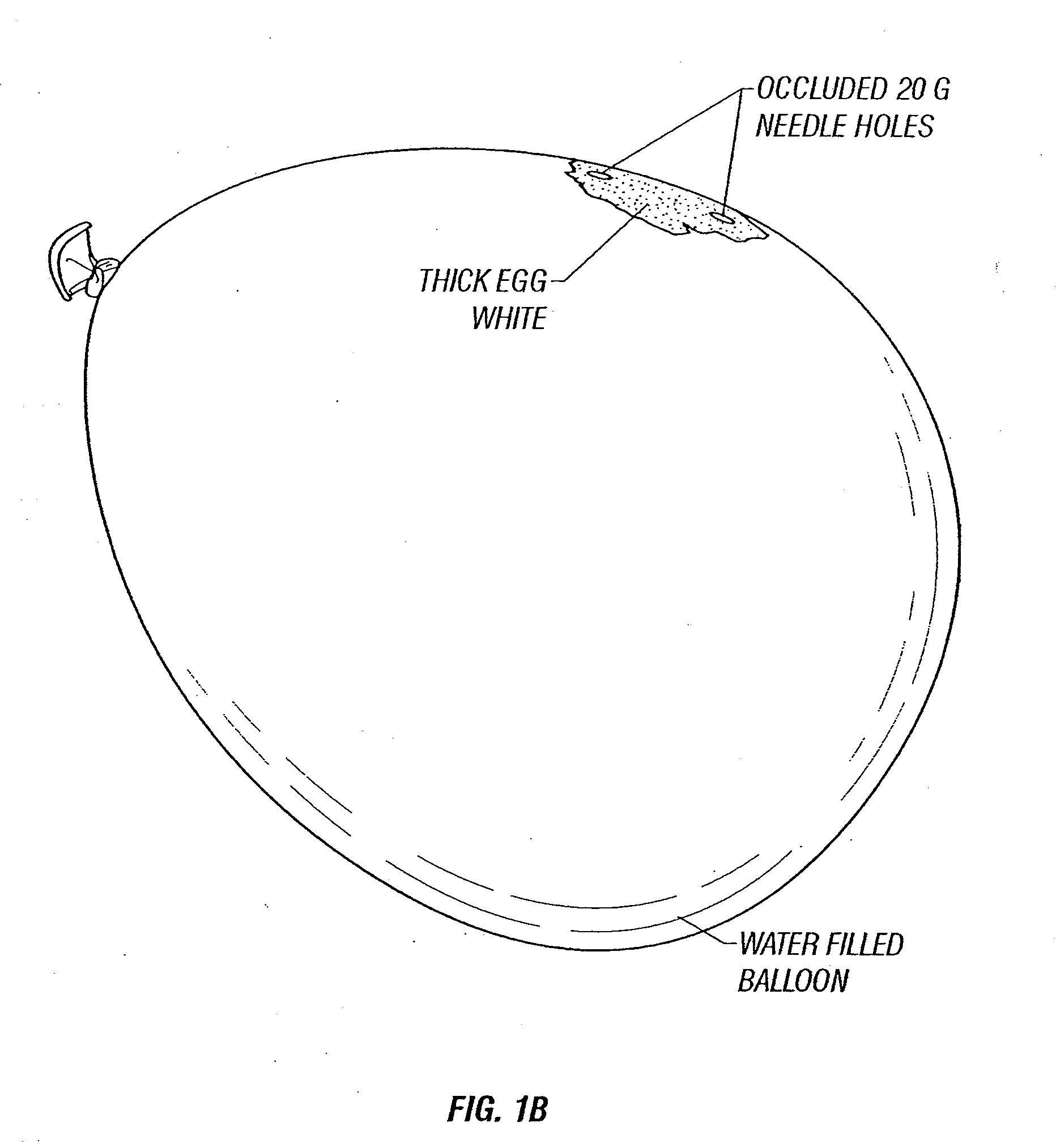 Repair of ruptured membrane by injection of naturally occurring protein in amniotic fluid sac