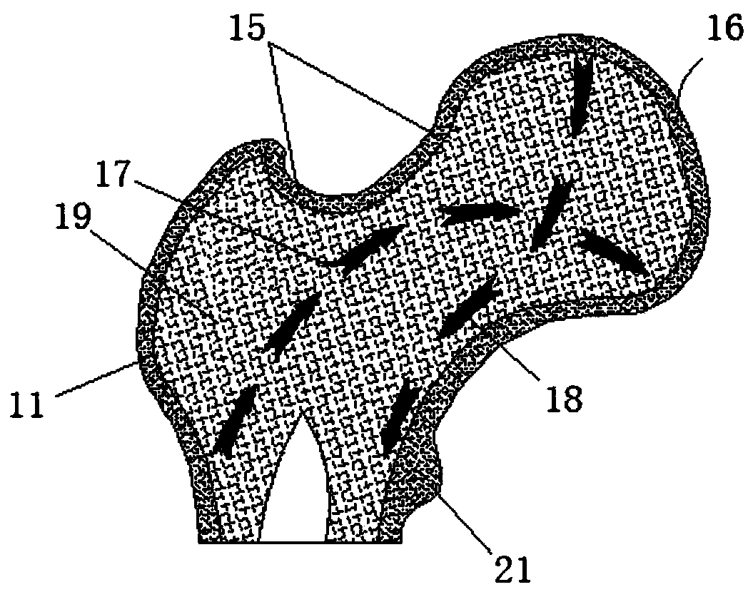 Fusion femoral stem system