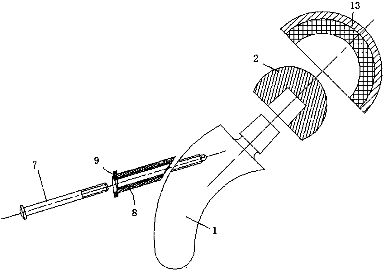 Fusion femoral stem system