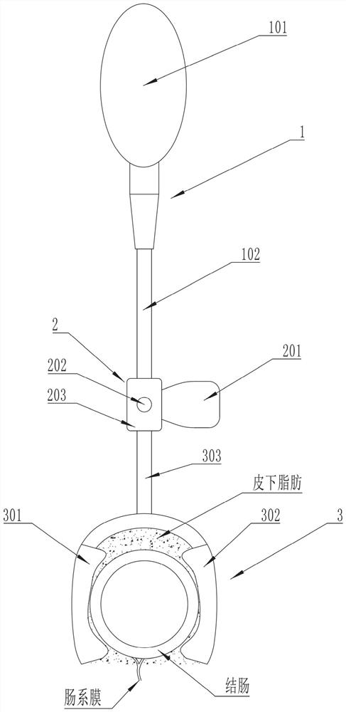 Colostomy plugging device