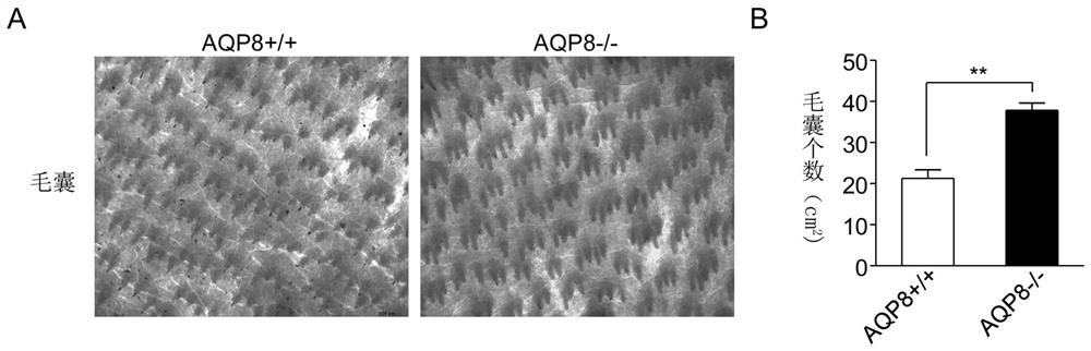 Method for increasing number of skin hair and accelerating hair growth speed