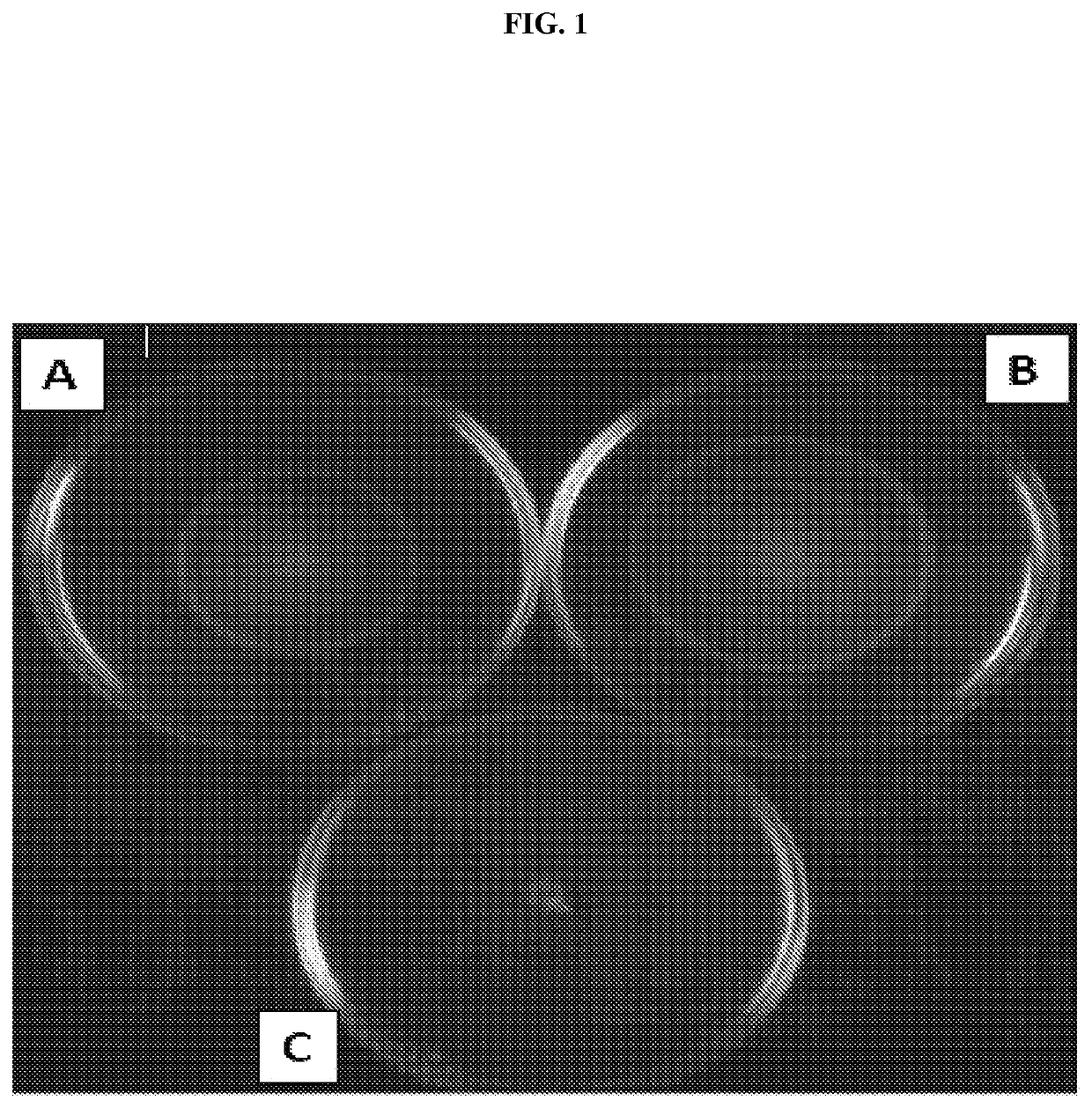 Antibodies against microorganisms and uses thereof