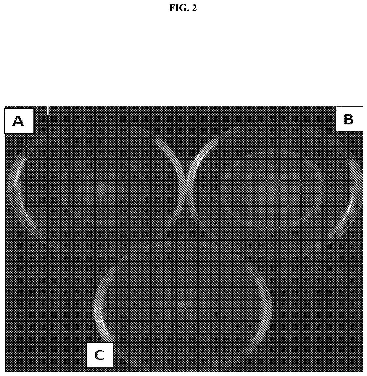 Antibodies against microorganisms and uses thereof