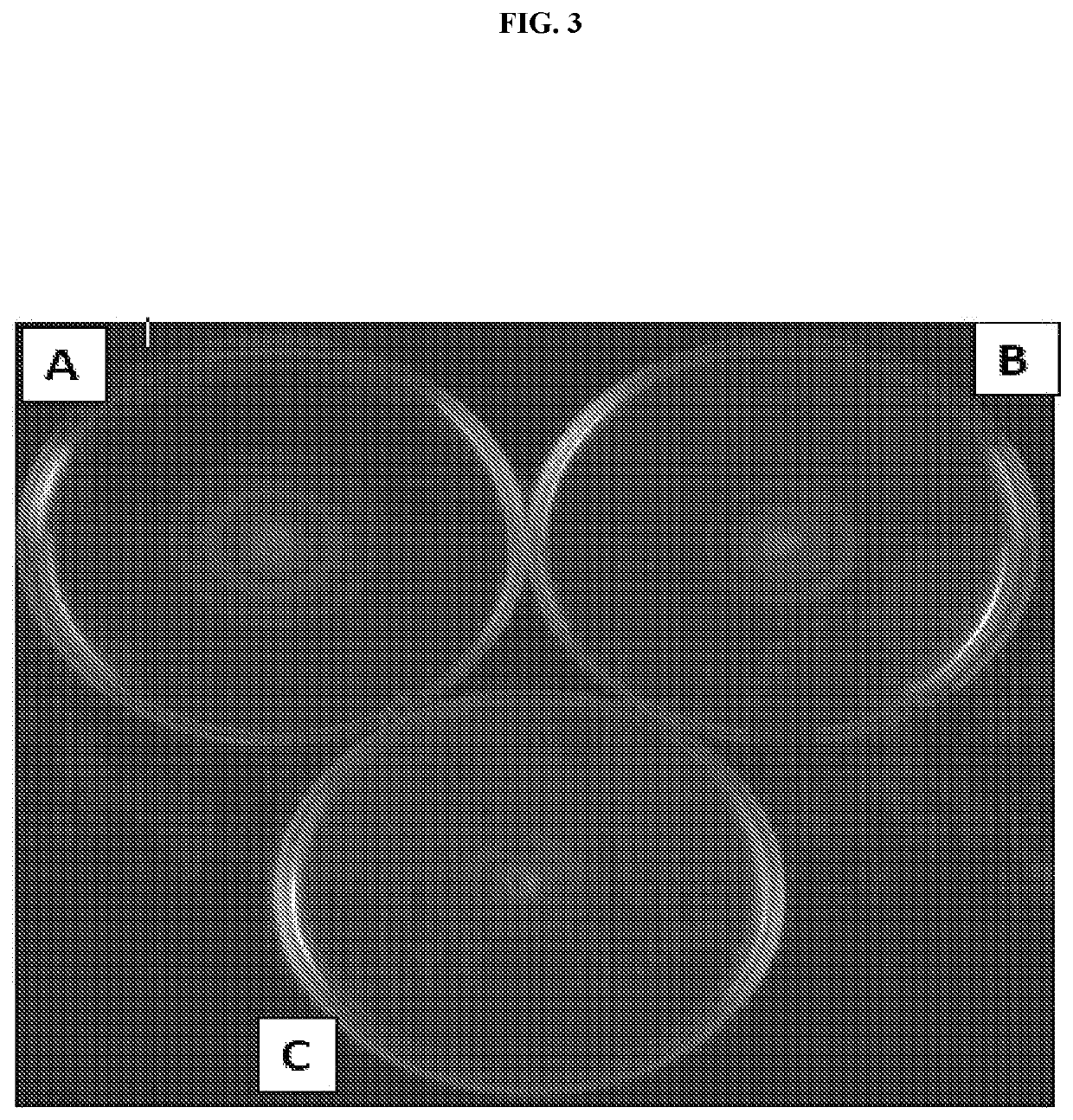 Antibodies against microorganisms and uses thereof