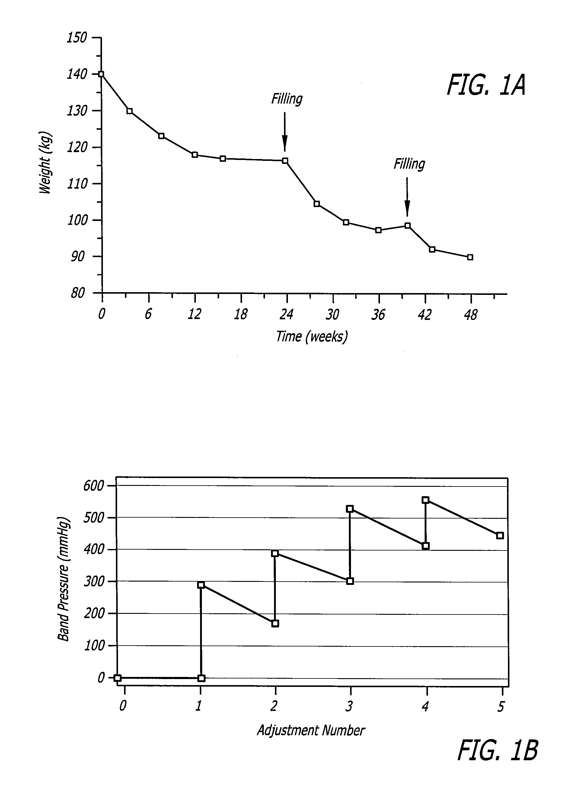 Assembly and method for automatically controlling pressure for a gastric band