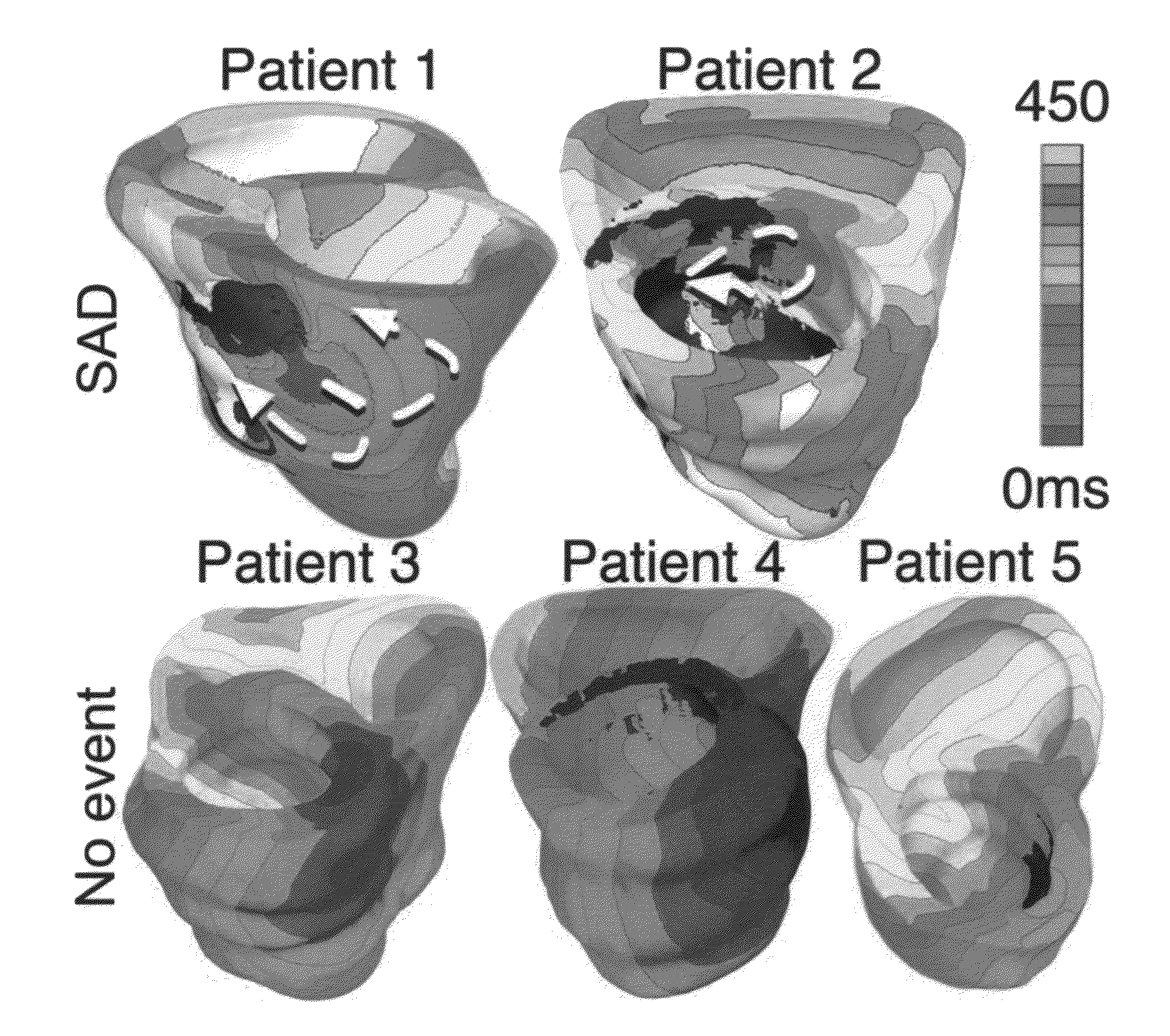 System and method for personalized cardiac arrhythmia risk assessment by simulating arrhythmia inducibility