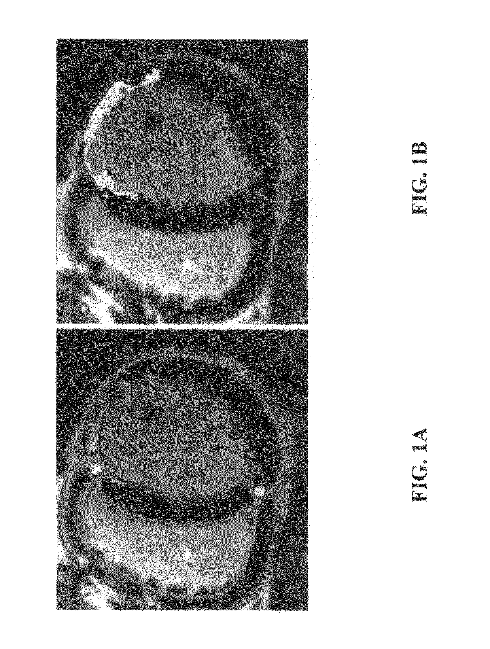 System and method for personalized cardiac arrhythmia risk assessment by simulating arrhythmia inducibility