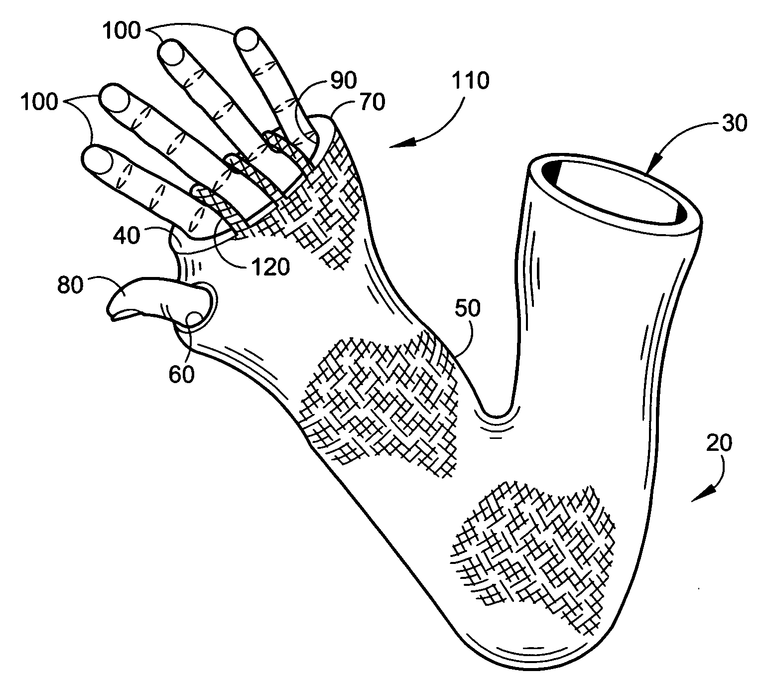 Cast cover and method of use