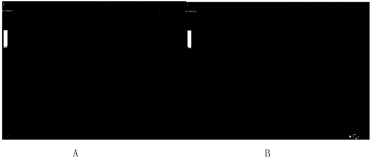 System for monitoring puerperal uterus inner pressure in real time and using method thereof