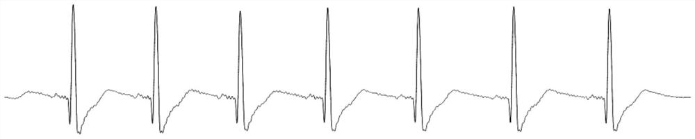 Signal processing method and device