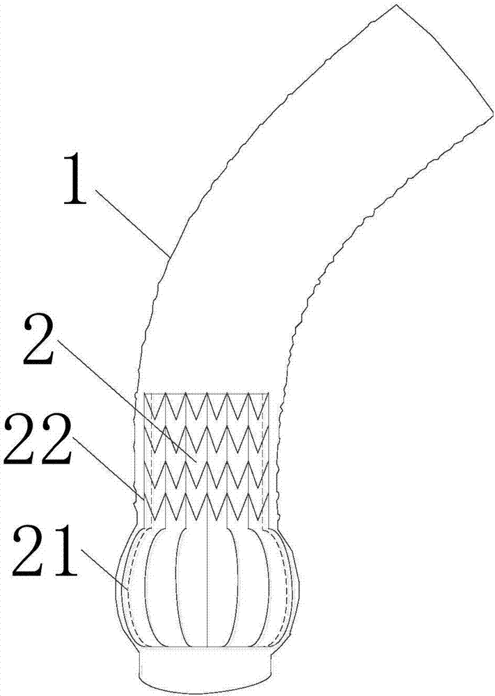 Valved conduit device for aortic root