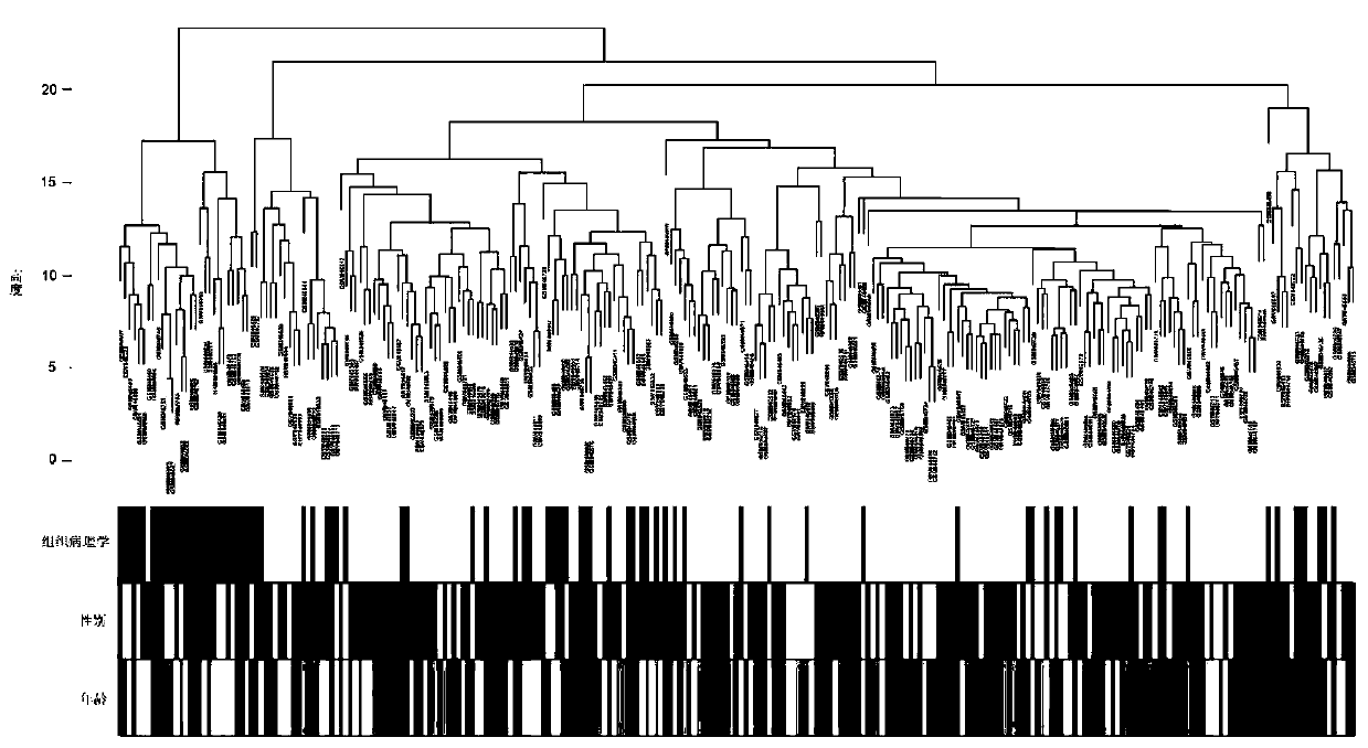 Specific gene markers for TMT (thyroid malignant tumor) and application of specific gene markers