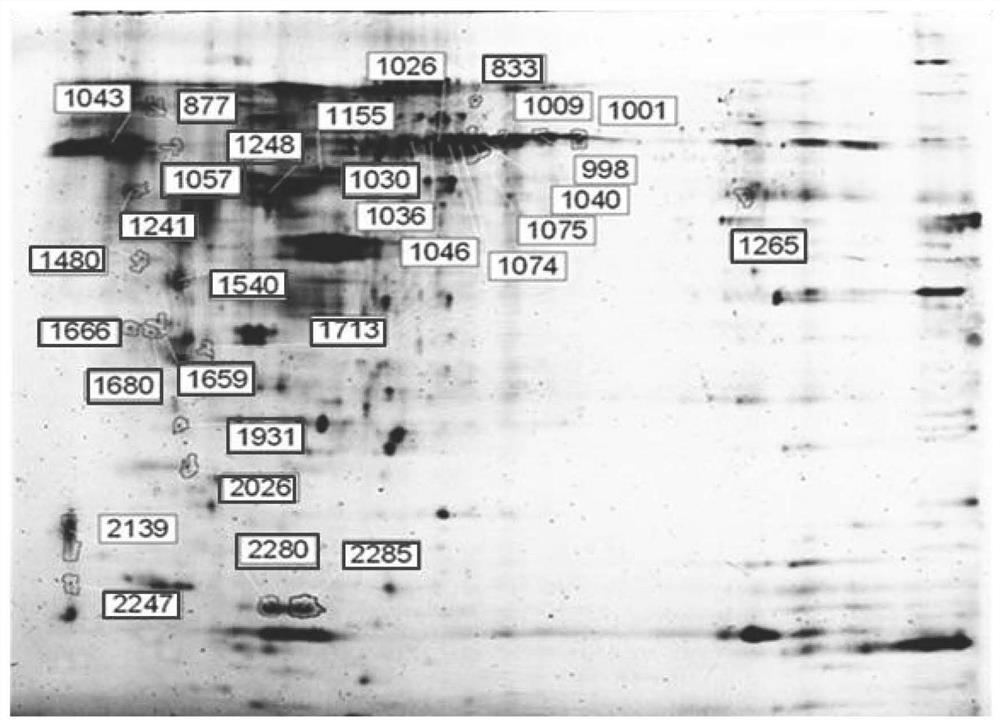 Application of preparation for regulating and controlling expression quantity of HSP90B1 in preparation of medicine for preventing or treating polycystic ovarian syndrome