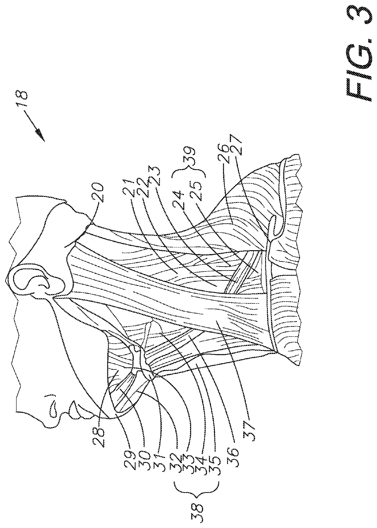 Concussion avoidance training system and method