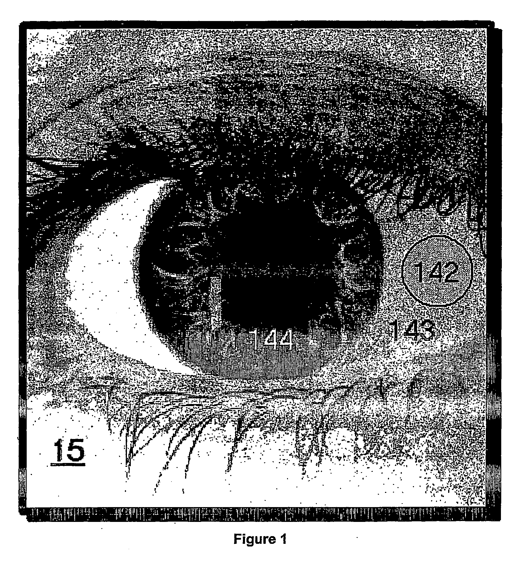 Transcleral opthalmic illumination method and system