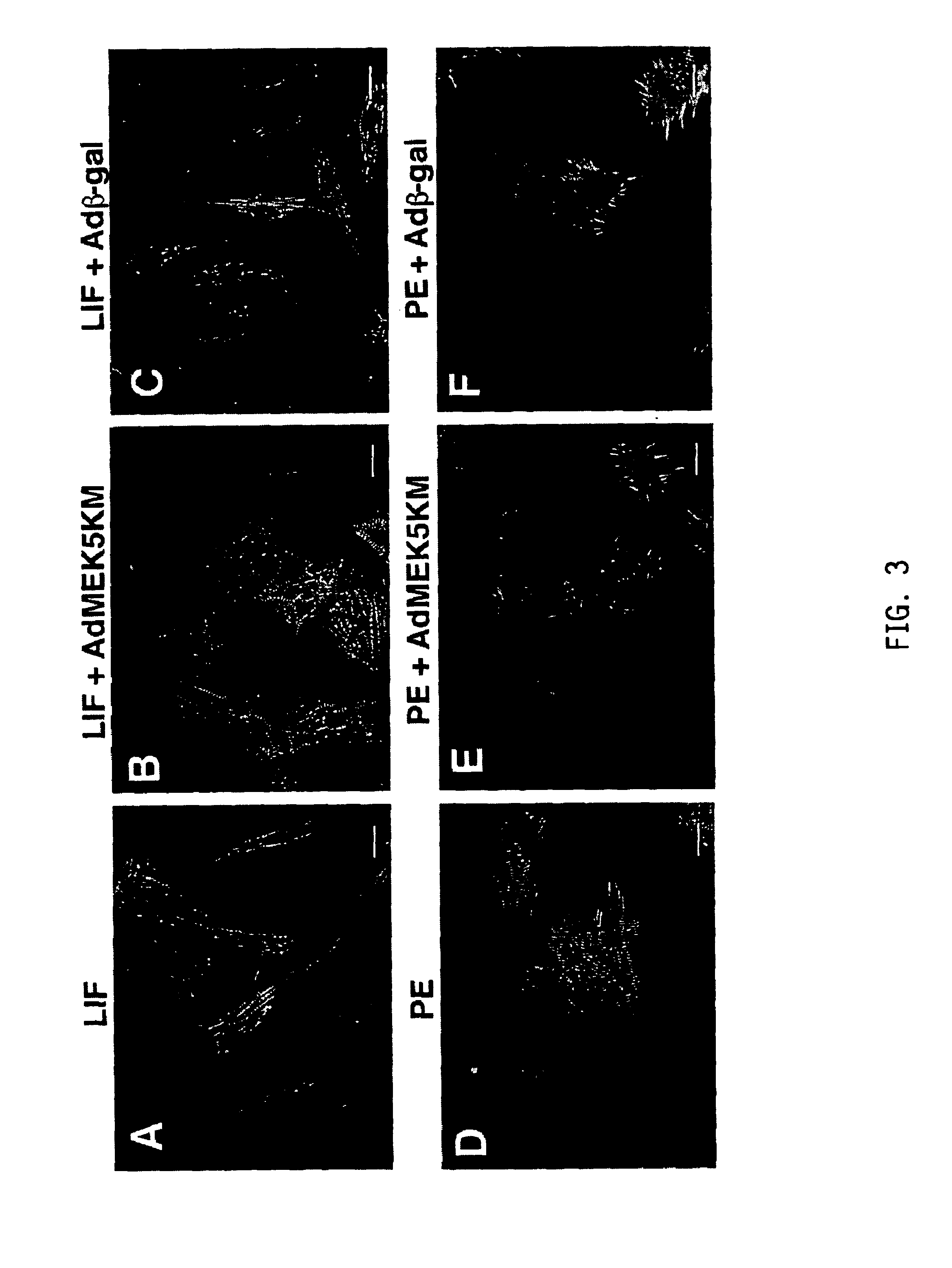 Transgenic mice comprising a constitutively-activated MEK5 and exhibiting cardiac hypertrophy and dilated cardiomyopathy