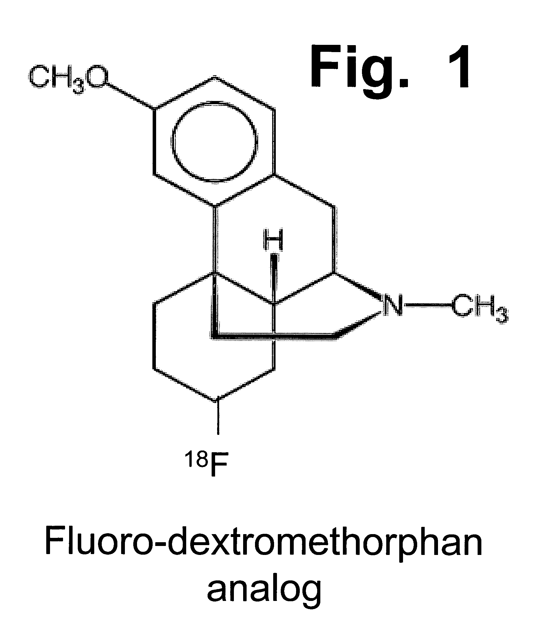 Enhancement of impaired motor and mental functions, using dextromethorphan and oxidase enzyme inhibitor