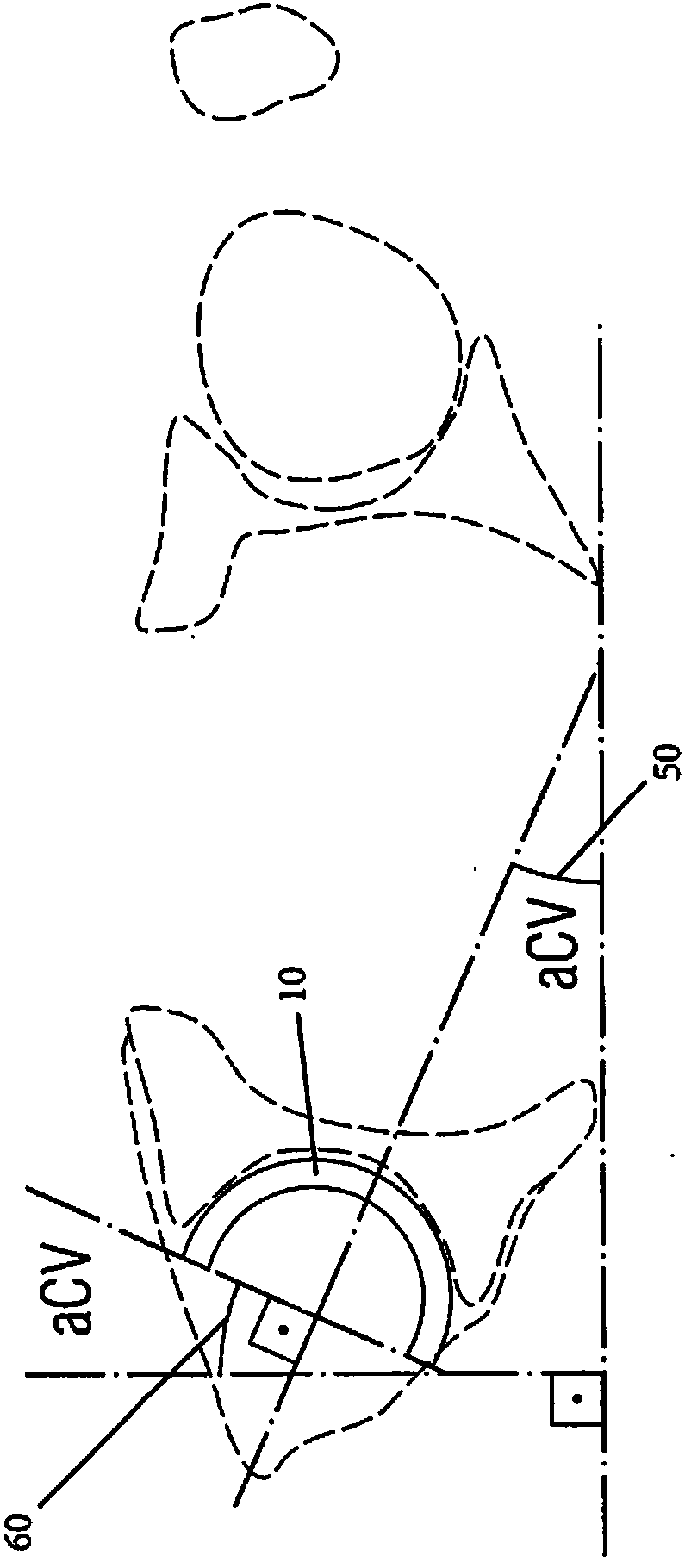 A fluoroscopy-based technique to measure intraoperative cup anteversion