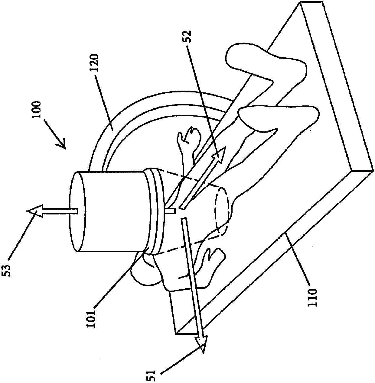 A fluoroscopy-based technique to measure intraoperative cup anteversion