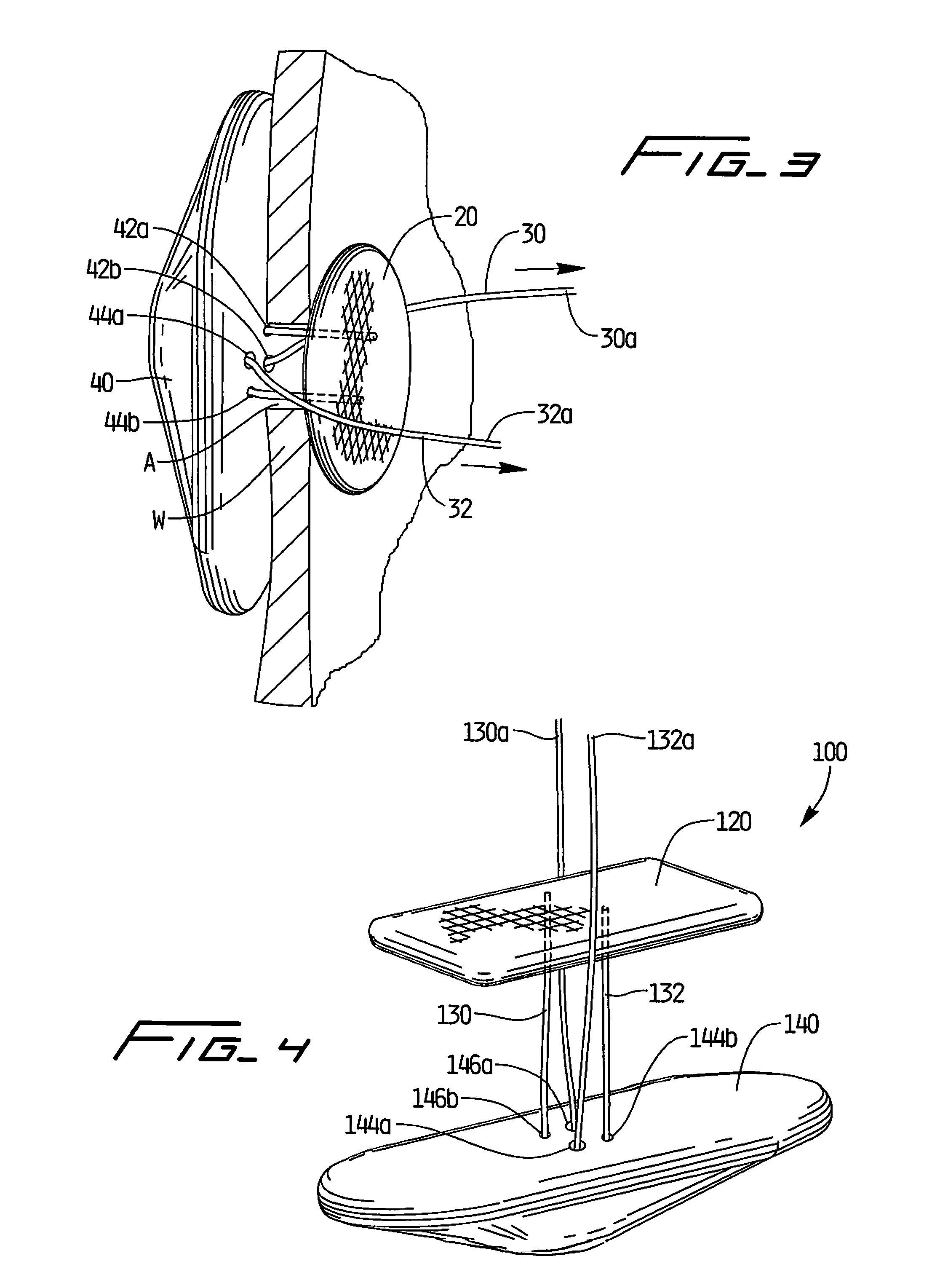 Vascular hole closure device