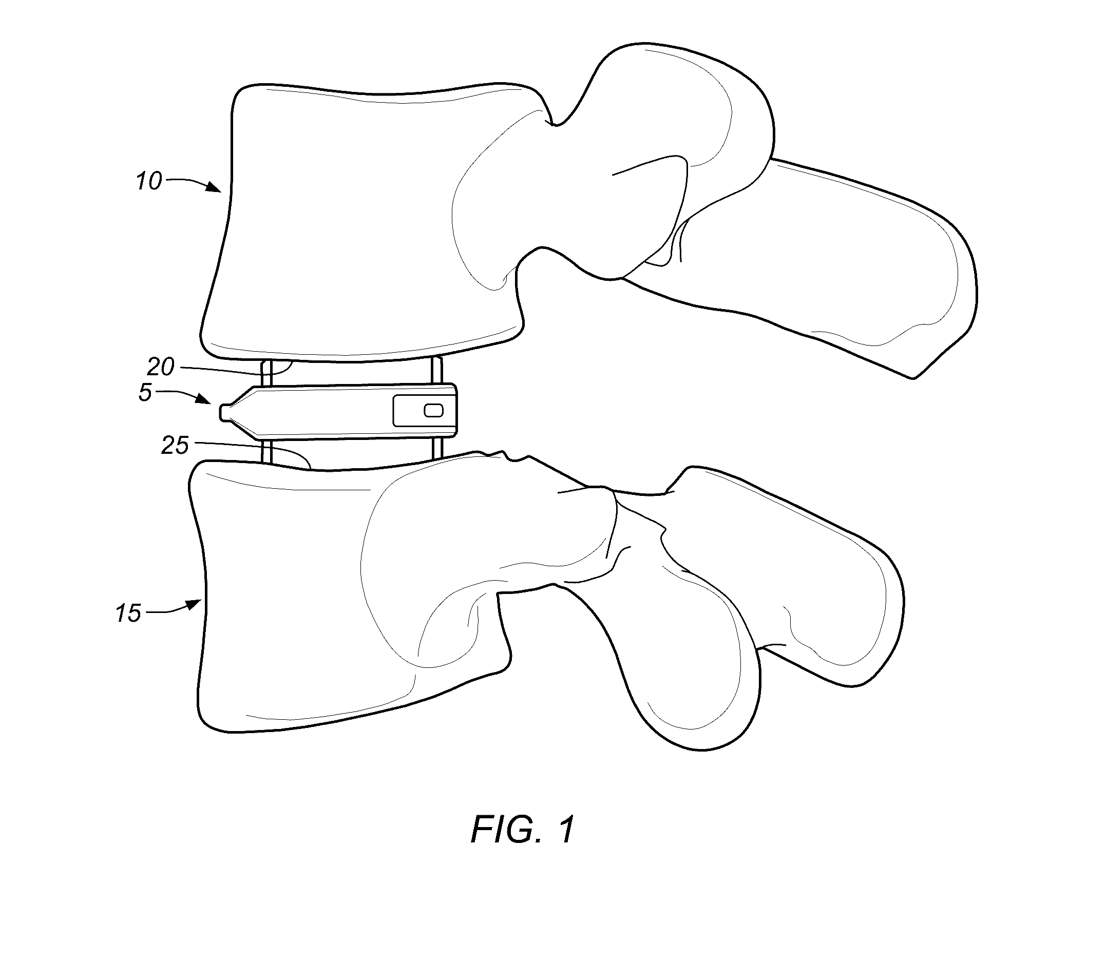 Expandable fusion device for positioning between adjacent vertebral bodies