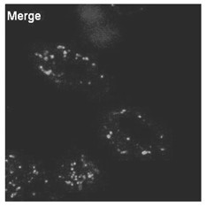 Lysosome targeted fluorescent substance and synthesis method thereof