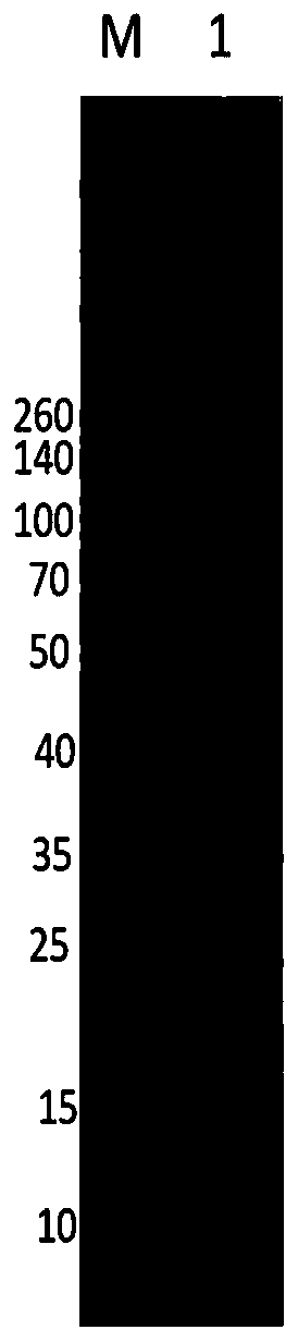 Nano-antibody combination for detecting carcino-embryonic antigen by double-antibody sandwich method