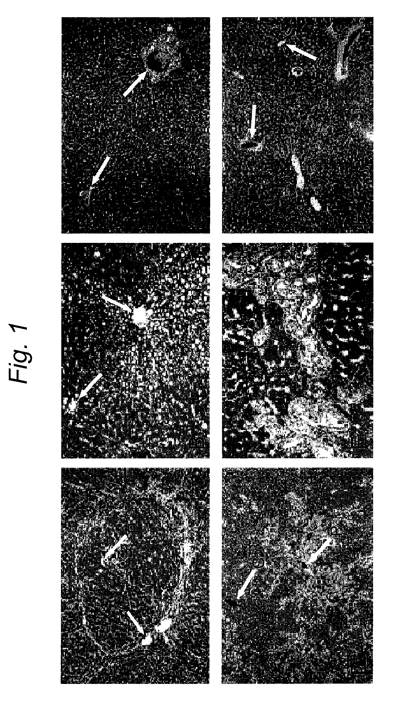 Preparative regimen for engraftment, growth and differentiation of non-hematopoeitic cells in vivo after transplantation