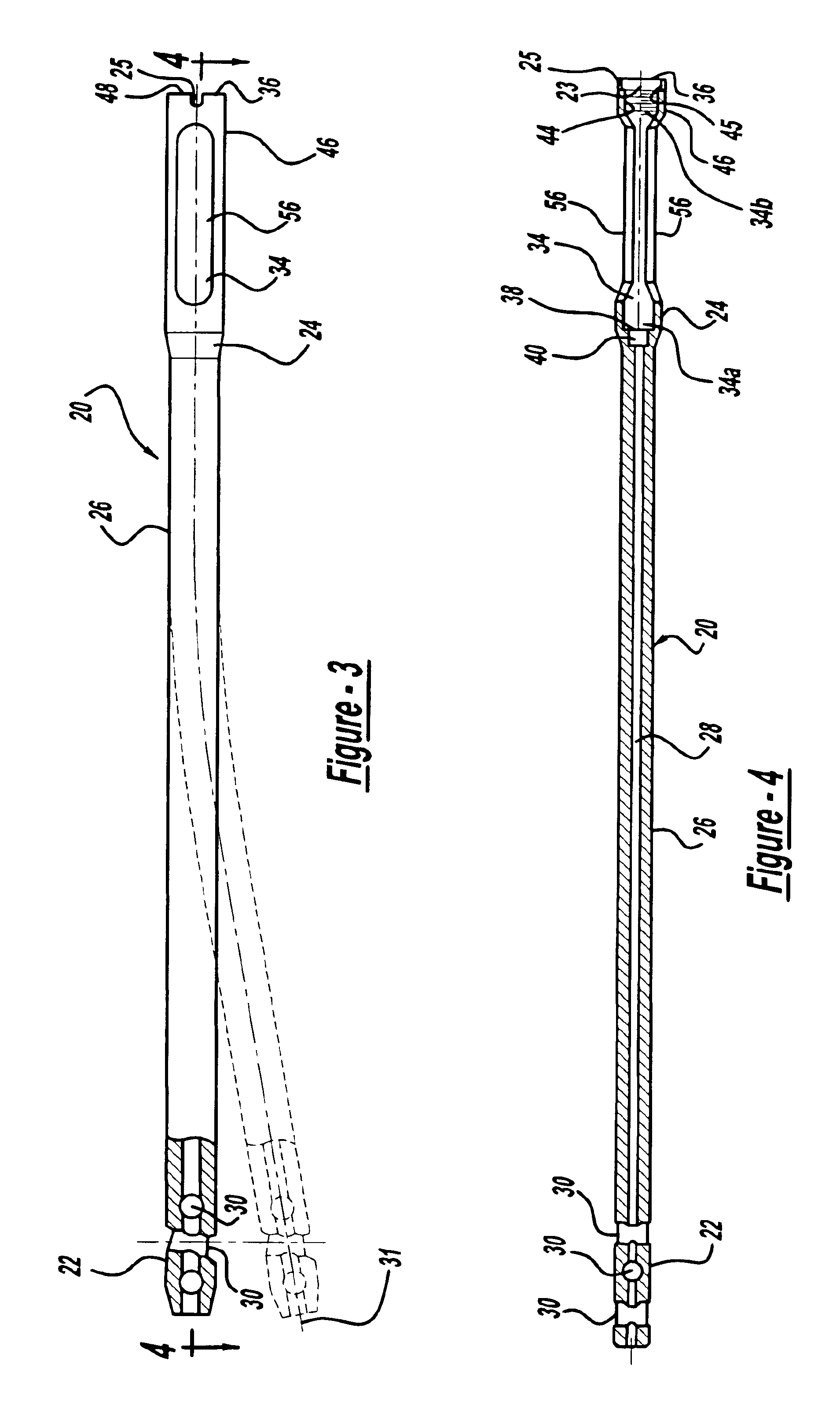 Modular intramedullary nail