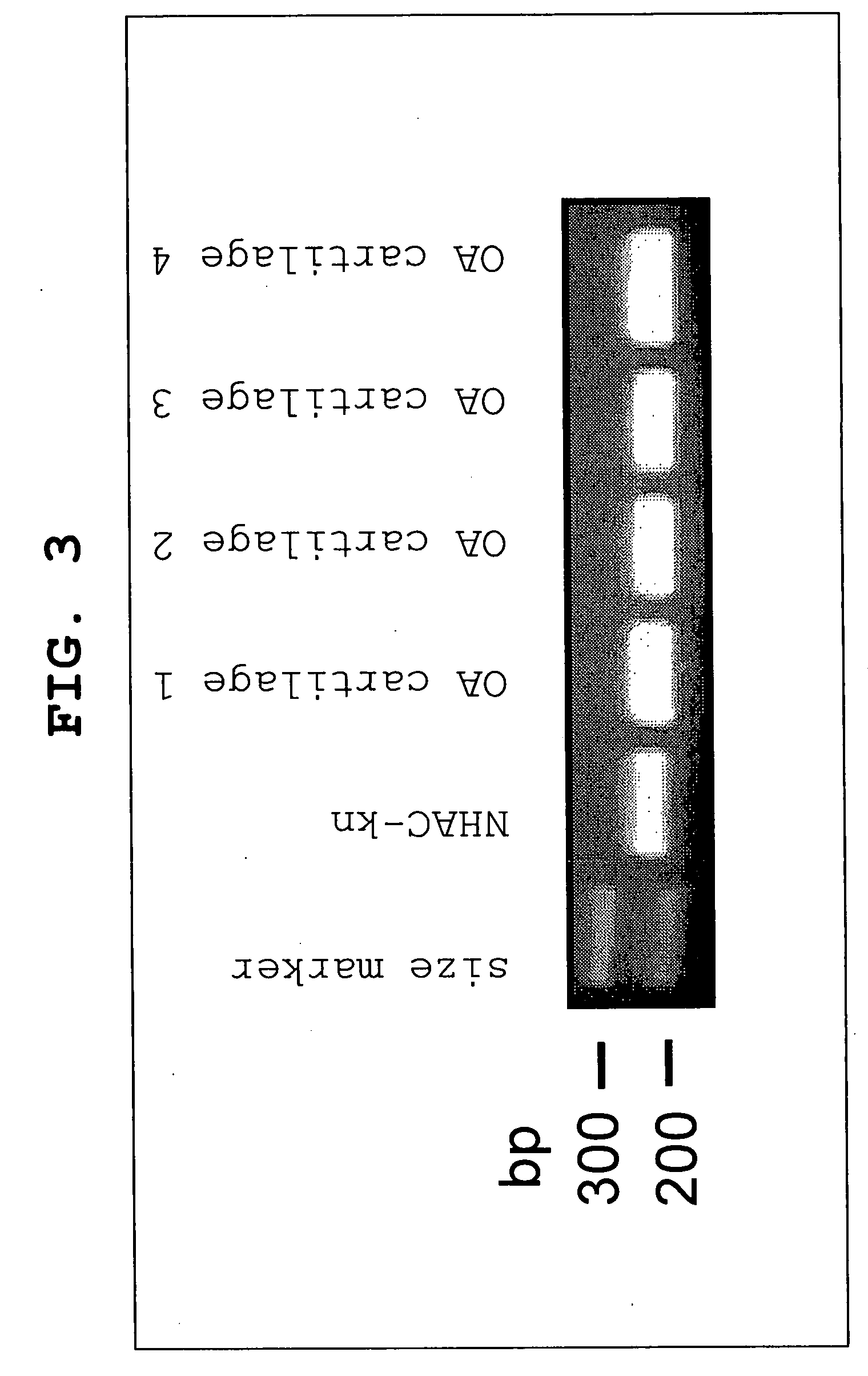 Bone/joint disease sensitivity gene and use thereof