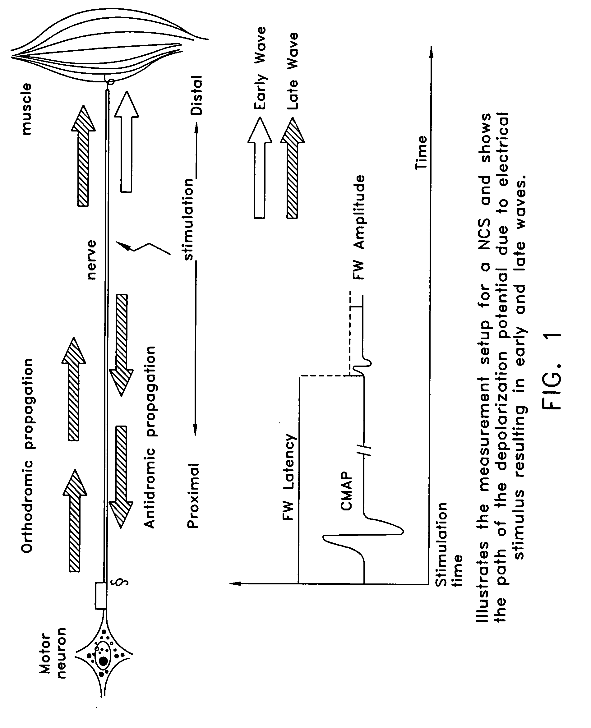 Detection and classification of neuromuscular late wave activity for the assessment of neuromuscular function