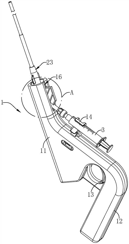 A microcatheter treatment device for intravenous closure