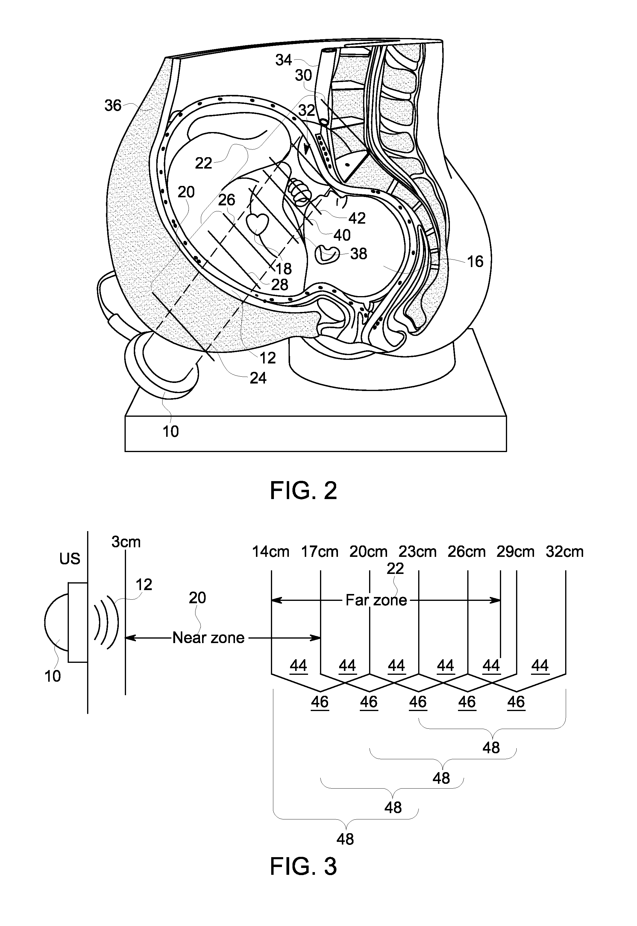 Method and device for fetal heart rate monitoring with maternal contribution detection