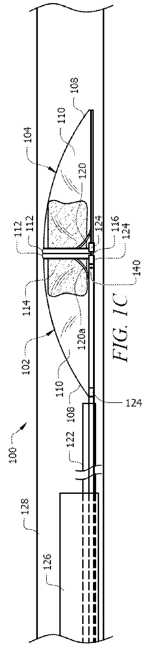 Clot removal device and method of using same