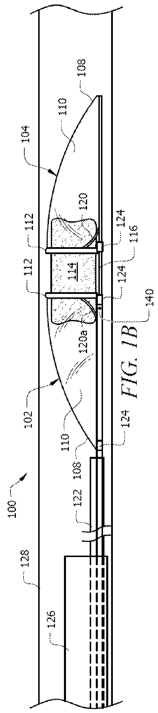 Clot removal device and method of using same