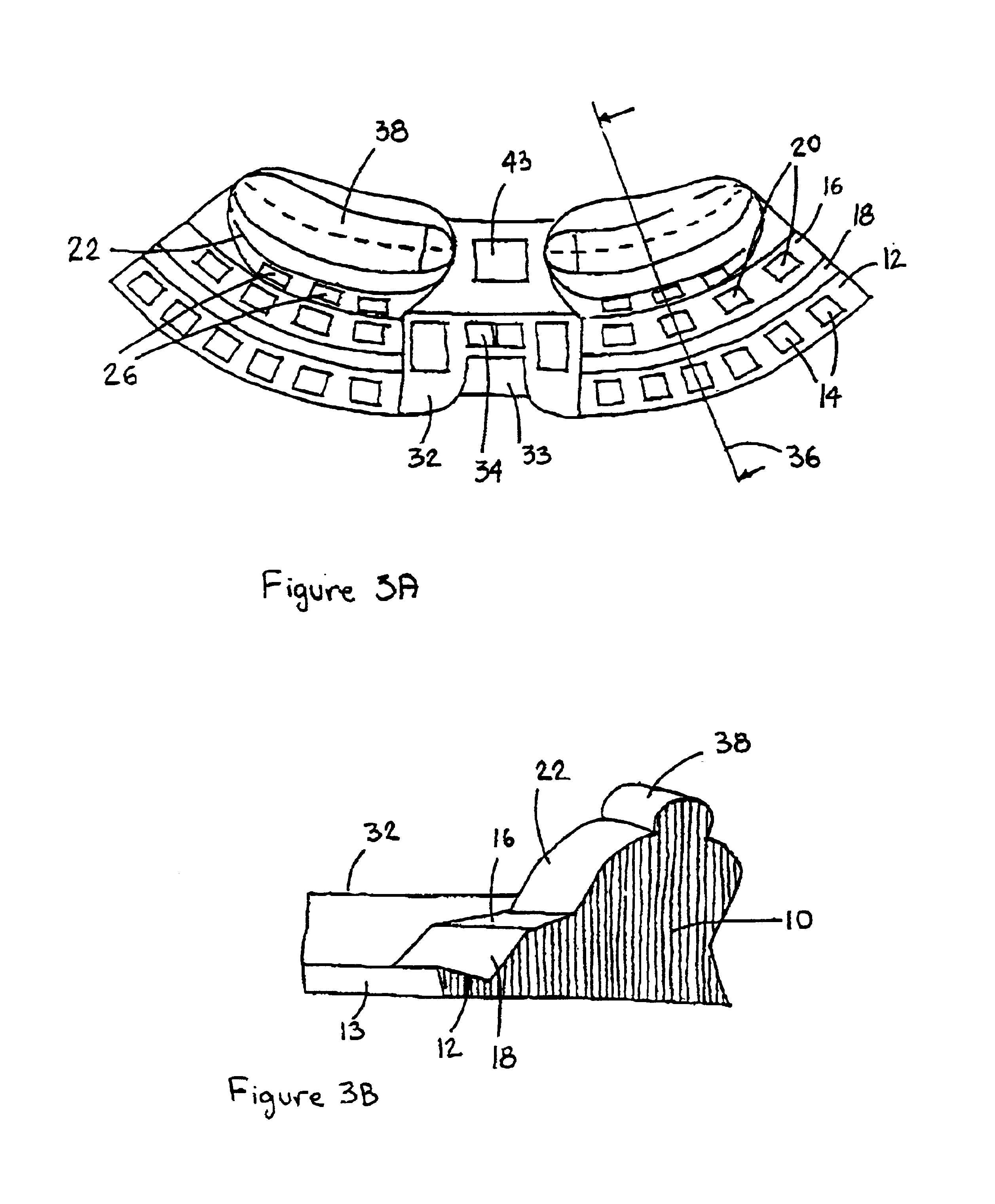 Ergonomic keyboard