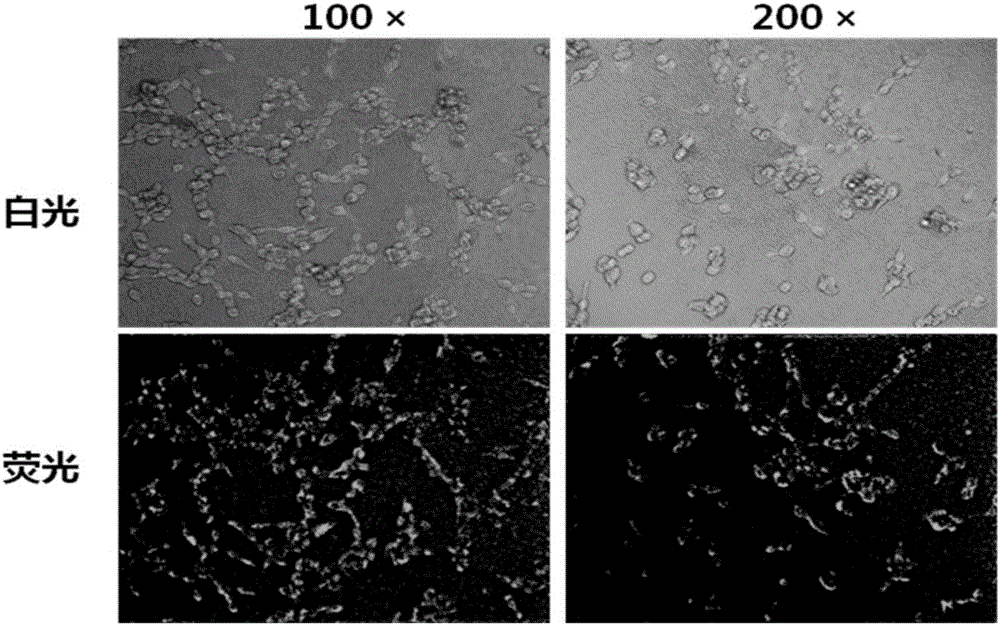 Attenuated salmonella typhimurium mediated eukaryocyte plasmid transfection method