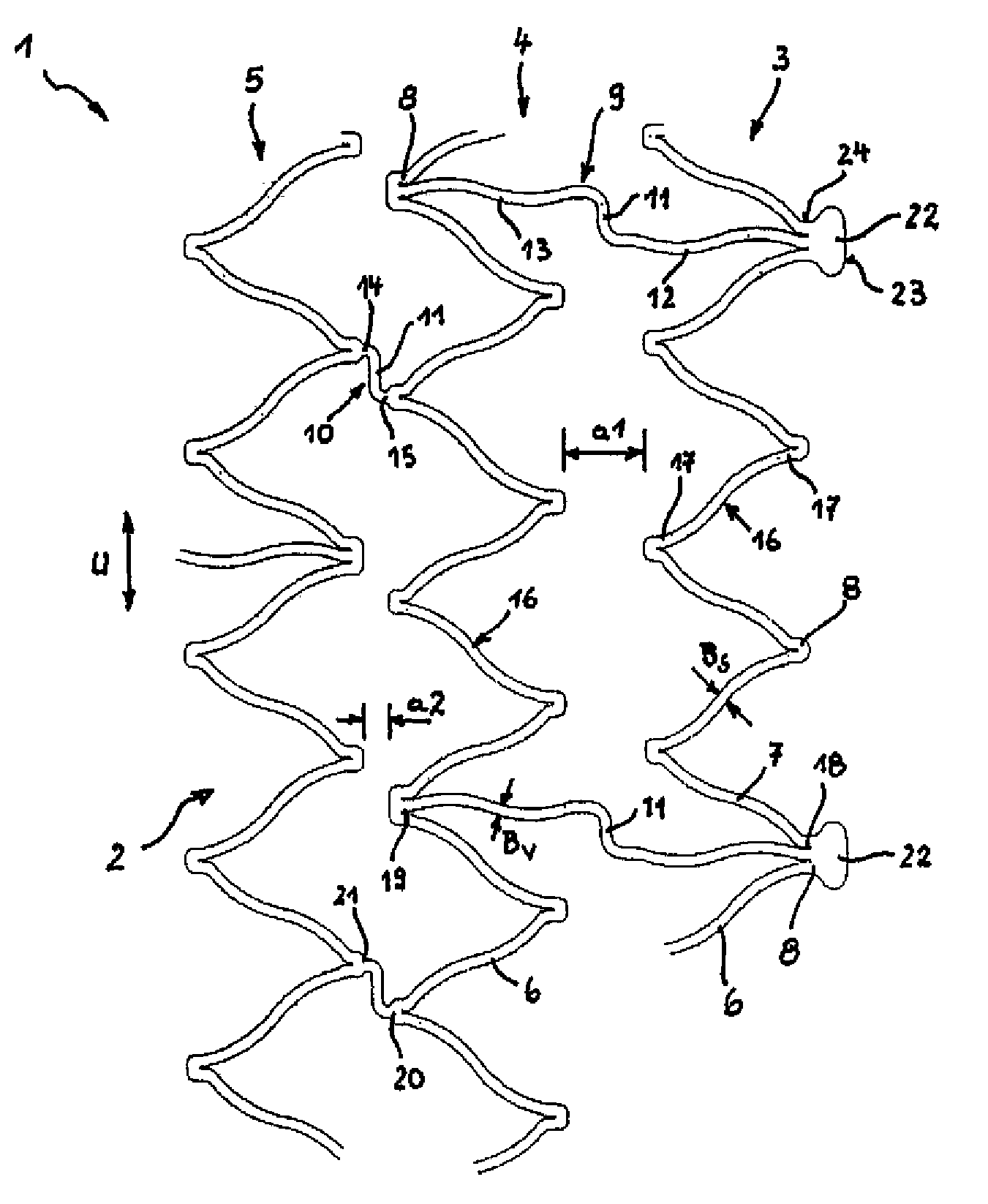 Stent