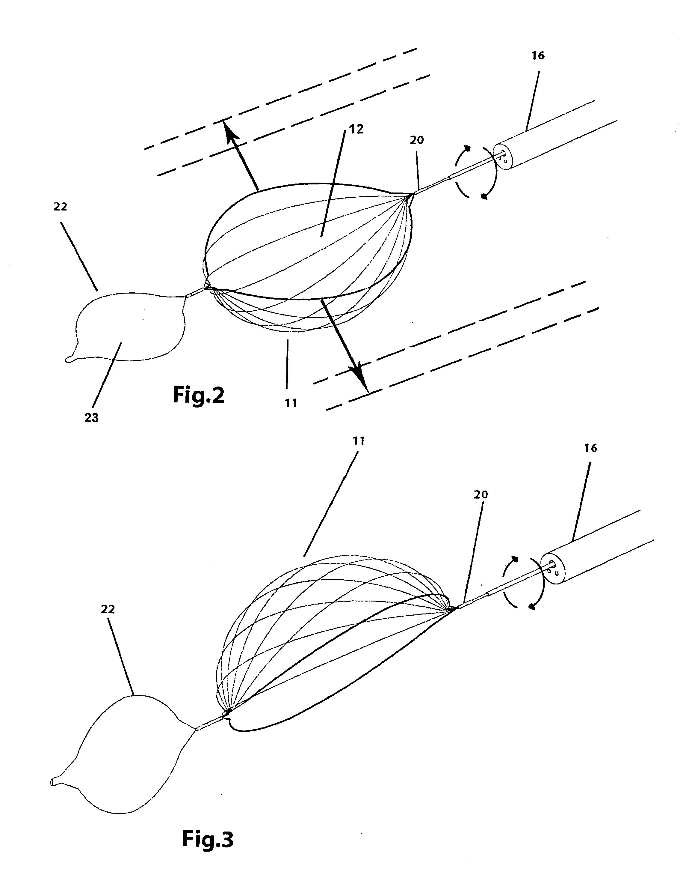 Surgical retrieval device and method