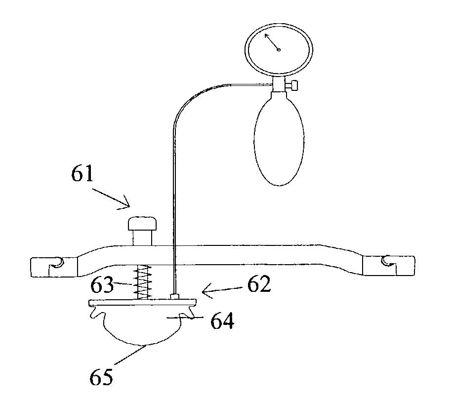 Femoral compression device with progressive pressure device